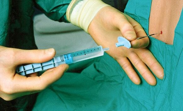 injection treatment of osteochondrosis