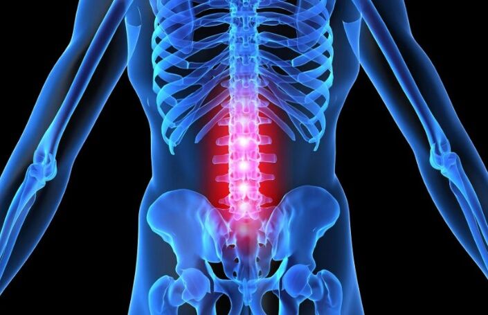 Osteocondrosis of the Lumbar region