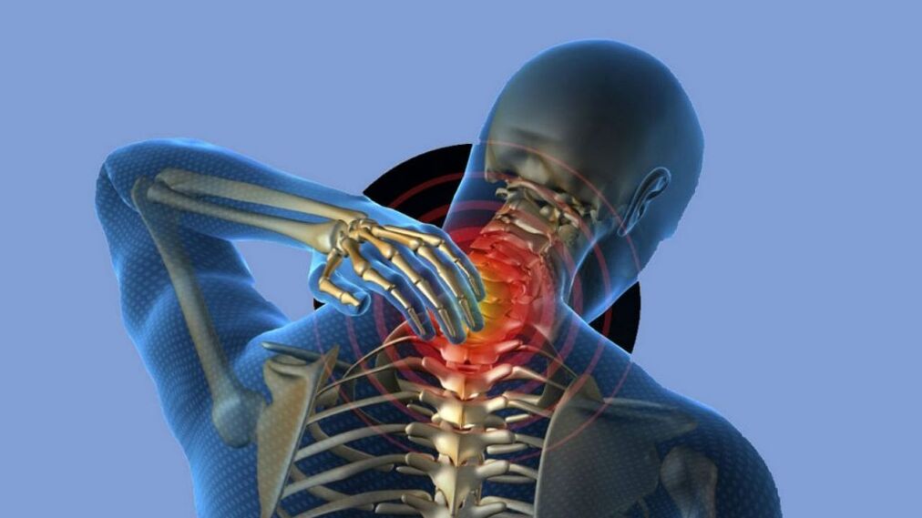 Osteocondrosis of cervical region