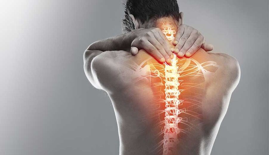 Osteocondrosis of the neck