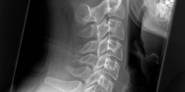 Photo of the cervical region