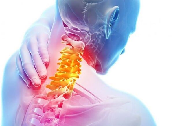 Osteocondrosis of cervical waist