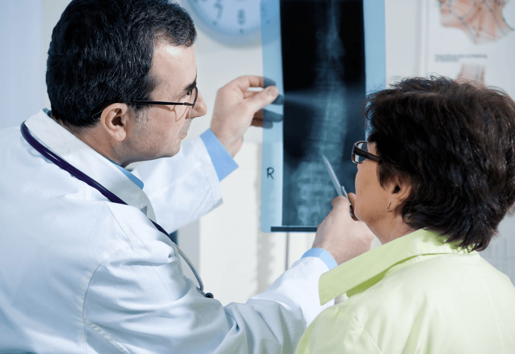A neurologist diagnoses osteochondrosis using X-rays of the spine